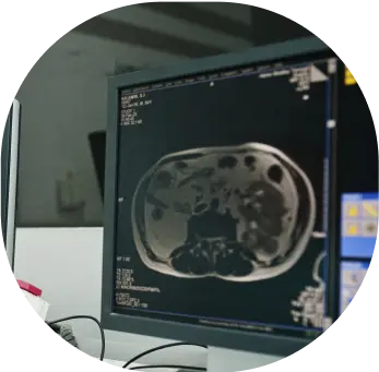 neurofeedback adolescentes